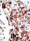 Protein Inhibitor Of Activated STAT 2 antibody, abx026846, Abbexa, Immunohistochemistry paraffin image 