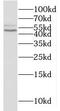 Nicotinate Phosphoribosyltransferase antibody, FNab05548, FineTest, Western Blot image 