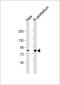 Propionyl-CoA Carboxylase Subunit Alpha antibody, 56-351, ProSci, Western Blot image 