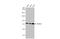 Acyl-CoA Synthetase Long Chain Family Member 3 antibody, GTX112431, GeneTex, Western Blot image 