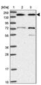 SET Binding Factor 2 antibody, PA5-62271, Invitrogen Antibodies, Western Blot image 