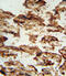Insulin Like Growth Factor Binding Protein 4 antibody, abx033083, Abbexa, Immunohistochemistry paraffin image 