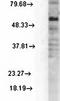 Gamma-Aminobutyric Acid Type A Receptor Delta Subunit antibody, orb67433, Biorbyt, Western Blot image 