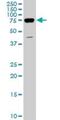 DEAD-Box Helicase 3 Y-Linked antibody, H00008653-M01, Novus Biologicals, Western Blot image 