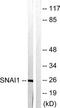 Snail Family Transcriptional Repressor 1 antibody, TA316497, Origene, Western Blot image 