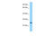 Collagen triple helix repeat-containing protein 1 antibody, ARP59864_P050, Aviva Systems Biology, Western Blot image 