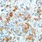 c-met antibody, AF3950, R&D Systems, Immunohistochemistry paraffin image 