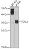 FOS Like 2, AP-1 Transcription Factor Subunit antibody, GTX64443, GeneTex, Western Blot image 