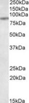 Antigen peptide transporter 1 antibody, MBS422714, MyBioSource, Western Blot image 