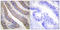 Neutrophil Cytosolic Factor 1 antibody, LS-C118013, Lifespan Biosciences, Immunohistochemistry paraffin image 