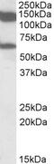 LARGE Xylosyl- And Glucuronyltransferase 1 antibody, 42-560, ProSci, Western Blot image 