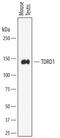 Tudor Domain Containing 1 antibody, AF7320, R&D Systems, Western Blot image 