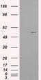 Interferon Induced Protein With Tetratricopeptide Repeats 1 antibody, TA500948, Origene, Western Blot image 