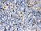 Cystatin A antibody, PB9564, Boster Biological Technology, Immunohistochemistry paraffin image 