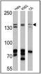 c-Kit antibody, PA5-16770, Invitrogen Antibodies, Western Blot image 