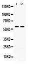 Chaperonin Containing TCP1 Subunit 3 antibody, PB9926, Boster Biological Technology, Western Blot image 