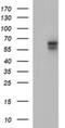 Interleukin 10 Receptor Subunit Alpha antibody, NBP2-46049, Novus Biologicals, Western Blot image 