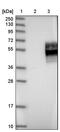 Interferon Gamma Receptor 2 antibody, PA5-51596, Invitrogen Antibodies, Western Blot image 
