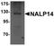 NLR Family Pyrin Domain Containing 14 antibody, PA5-21029, Invitrogen Antibodies, Western Blot image 