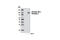 Insulin Like Growth Factor 1 Receptor antibody, 2969S, Cell Signaling Technology, Western Blot image 