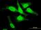 DNA Topoisomerase III Beta antibody, H00008940-M05, Novus Biologicals, Immunofluorescence image 