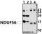 NADH:Ubiquinone Oxidoreductase Subunit S6 antibody, A09082, Boster Biological Technology, Western Blot image 