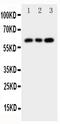 Checkpoint Kinase 2 antibody, PA1655, Boster Biological Technology, Western Blot image 