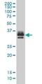 ST3 Beta-Galactoside Alpha-2,3-Sialyltransferase 2 antibody, H00006483-M01, Novus Biologicals, Western Blot image 