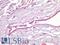 Mesothelin antibody, LS-A12014, Lifespan Biosciences, Immunohistochemistry paraffin image 