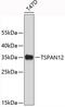 Tetraspanin 12 antibody, 19-415, ProSci, Western Blot image 