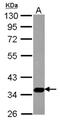 Sialin antibody, NBP2-20383, Novus Biologicals, Western Blot image 