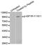 Insulin Like Growth Factor 1 Receptor antibody, STJ22186, St John