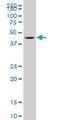 DEAF1 Transcription Factor antibody, H00010522-M06, Novus Biologicals, Western Blot image 