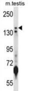 Lysine Demethylase 5B antibody, abx028081, Abbexa, Western Blot image 