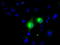 Microseminoprotein Beta antibody, TA501072, Origene, Immunofluorescence image 