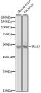 Interleukin 1 Receptor Associated Kinase 4 antibody, GTX33274, GeneTex, Western Blot image 