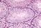 GLI Family Zinc Finger 2 antibody, MBS240221, MyBioSource, Immunohistochemistry frozen image 