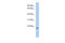 ChaC Cation Transport Regulator Homolog 2 antibody, 31-330, ProSci, Enzyme Linked Immunosorbent Assay image 