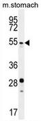 Histone-lysine N-methyltransferase SUV420H2 antibody, AP54116PU-N, Origene, Western Blot image 