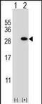 Glutathione S-transferase theta-1 antibody, PA5-35127, Invitrogen Antibodies, Western Blot image 