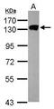 Minichromosome Maintenance Complex Component 2 antibody, GTX103071, GeneTex, Western Blot image 