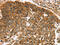 TNF Superfamily Member 15 antibody, CSB-PA065340, Cusabio, Immunohistochemistry paraffin image 