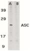 PYD And CARD Domain Containing antibody, PA5-19957, Invitrogen Antibodies, Western Blot image 
