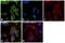 ATPase H+ Transporting V1 Subunit E1 antibody, PA5-29899, Invitrogen Antibodies, Immunofluorescence image 
