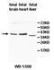 Zinc Finger MYND-Type Containing 19 antibody, orb77943, Biorbyt, Western Blot image 