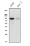 Integrin Subunit Beta 5 antibody, A04201-1, Boster Biological Technology, Western Blot image 