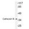 Cathepsin B antibody, TA336744, Origene, Western Blot image 