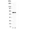 Calcium/Calmodulin Dependent Protein Kinase Kinase 1 antibody, R30595, NSJ Bioreagents, Western Blot image 