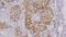 WT1 Transcription Factor antibody, GTX01958, GeneTex, Immunohistochemistry paraffin image 