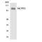 Microcephalin 1 antibody, LS-C292175, Lifespan Biosciences, Western Blot image 